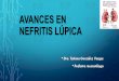 Avances en nefritis lupica...elevados en NL que en LESp sin nefritis (Pc