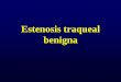 Estenosis traqueal benigna · •Evaluar siempre con broncoscopía. CONCLUSIONES •Siempre realizar una evaluación prequirúrgica de la glotis. •El tratamiento de elección es