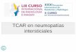 TCAR en neumopatías intersticiales · • Diferenciar Idiopática (IPF) vs secundaria • Las GUIAS para el diagnóstico ayudan a reconocer el patrón característico y muchas veces
