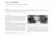 LEIOMIOMATOSIS DIFUSA UTERINA ABDOMEN AGUDO POCO … SEGURA.pdf · Paciente de 38 años de sexo femenino, nuligesta, con diagnóstico de miomatosis uterina sintomática, confirmada
