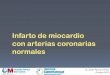 Infarto de miocardio con arterias coronarias normales · Infarto de miocardio con arterias coronarias normales Dr. Julián Palacios Rubio Octubre 2012