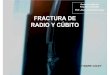 Prof. José Luis Morales López FRACTURA DE RADIO Y CÚBITO€¦ · - Perro presenta una fractura situada en los 2/3 distales del radio y cúbito de la extremidad anterior izquierda