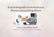 Ecocardiografía transtorácica: Planos ecocardiográficoscriticos.enfermeriaencardiologia.com/.../planos... · Planos ecocardiográficos . Posición del transductor: Ventana paraesternal