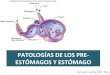 PATOLOGÍAS)DE)LOS)PRE- ESTÓMAGOS)Y)ESTÓMAGO)histolab.com.co/images/2017/digestivo/6.-Pre-estmagos.pdf · •Timpanismo)primario)(fermentación'alimen8cia)' – Inges8ón'de'leguminosas