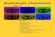 Radiología Abdominal - sedia.es · 2016-08-03 · Radiología Abdominal Pancreatitis Aguda: nueva clasificación basada en criterios de imagen Autor: Miguel González de Cabo. Hospital