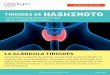 REEDUCACIÓN ALIMENTICIA ˇ ˛ˇ HASHIMOTO · La conexión del páncreas con la enfermedad de Hashimoto El páncreas es un órgano ubicado en la parte superior del abdomen. Consiste