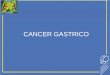 Cancer Gastrico Conferencia(Final) [Modo de compatibilidad] › wp-content › uploads › 2020 › 03 › tema17.pdf · Investigación sobre el Cáncer en 2002, informó que el CG