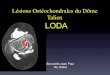 Lésions Ostéochondrales du Dôme Talien LODA · • Visco ou PRP de complément …. • 90% B et TB à 5 ans INDICATION • Forme O + de 1,5 cm2 • Suivant expérience de chacun