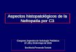 Aspectos histopatológicos de la Nefropatía por C3a/Nefro... · 2015-10-27 · Síndrome de POEMS (polineuropatía, organomegalia, endocrinopatía, proteína monoclonal, cambios