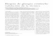 Biopsia de glangio centinela: validación de la técnica...Canarias Médica y Quirúrgica I Vol. 1 - N" 3 -1UU~ Veronesi2 encuentra que el ganglio centinela es el único ganglio afe