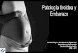 Patología tiroidea y Embarazo - WordPress.com...Hipotiroidismo Los requerimientos de tiroxina en mujeres con hipotiroidismo conocido aumentan en la gestación, lo que obliga a incrementar