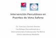 Intervención Percutánea en Puentes de Vena Safena€¦ · 3. Brilakis ES, Rao SV, Banerjee S, et al. Percutaneous coronary intervention in native arteries versus by- pass grafts