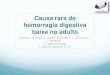 Causa rara de hemorragia digestiva baixa no adulto - NGHD · 2019-01-03 · Causa rara de hemorragia digestiva baixa no adulto I. Mocanu, S. Pires, N. Veloso, R. Godinho, L. Gonçalves,
