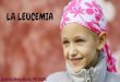 LA LEUCEMIAanatomia1bach.weebly.com/uploads/8/8/5/7/8857465/la... · 2018-09-06 · -Leucemia linfoide crónica (LLC) incluida dentro de los síndromes linfoproliferativos y equiparable