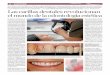 texto Las carillas dentales revolucionan el mundo de la ... · A la izquierda, una sonrisa antes de recibir el tratamiento de blanqueamiento dental y a la derecha el resultado obtenido