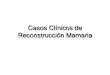 Caso Clínico de Reconstrucción Mamaria · 2017. 5. 22. · Casos Clínicos de Reconstrucción Mamaria Fernando Hernanz de la Fuente . Expansión-Prótesis . Diseño de colocación