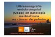 Ultrasonografía endobronquial (USEB) en patología ... · Cáncer de pulmón • Estadificación cáncer de pulmón –Sensibilidad 86-95% -Especificidad 100% –Mejor que PET/TAC