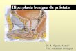 Hiperplasia benigna de próstata - UCM ppt.pdf · Hiperplasia del estroma fibromuscular y de las glándulas que adquieren un aspecto NODULAR. El aumento de los nódulos (aparecen