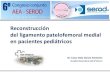 Reconstrucción del ligamento patelofemoral medial en ...€¦ · • Ligamento patelo-femoral medial – Restrictorprincipal de la luxación lateral de la rótula: 80% estabilidad