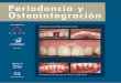 Periodoncia y Osteointegración · La unión dento-gingival. Análisis crítico del trabajo de Gargiulo y cols. (1961) Francisco M. Alpiste. Lesiones orales y gingivales asociadas
