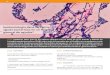 Epidemiología de la faringitis aguda bacteriana en un hospital …revistabioanalisis.com/images/flippingbook/rev 86n/nota 2... · 2019. 1. 31. · La faringitis aguda bacteriana