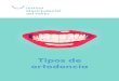 Tipos de ortodoncia · 2021. 2. 16. · coronas y puentes dentales. 14 ORTODONCIA DE PORCELANA O ZAFIRO. Ortodoncia 15 Funcionan de la misma manera que una ortodoncia convencional,