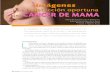 para la detección oportuna del CÁNCER DE MAMA … · El ultrasonido mamario es el método idóneo en la paciente menor de 40 años de edad, cuando presenta algún hallazgo clí-nico