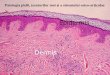 Patologia pielii, țesuturilor moi și a sistemului osteo 