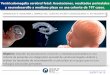 Ventriculomegalia cerebral fetal: Asociaciones, resultados 