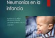 Neumonías en la infancia - Servicio de Salud Aconcagua