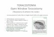 TORACOSTOMIA Open Window Toracostomy