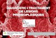 DIAGNÒSTIC I TRACTAMENT DE LESIONS PRENEOPLÀSIQUES