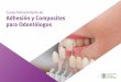 Curso Universitario en Adhesión y Composites para Odontólogos