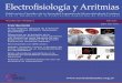 Electrofisiología y Arritmias