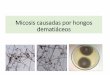 Micosis causadas por hongos dematiáceos
